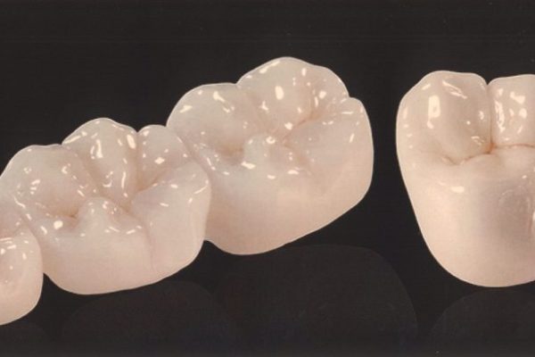 zirconia crowns