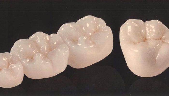 Zirconia-Crowns-1-768×409 zirconia crowns