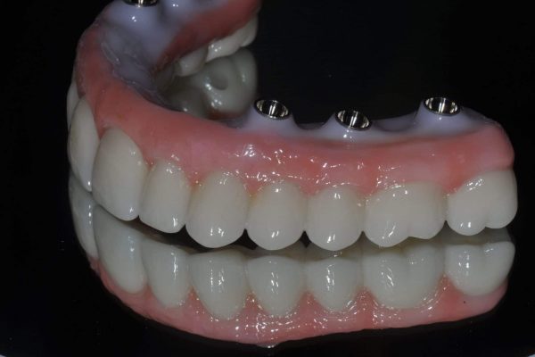 dental lab melbourne