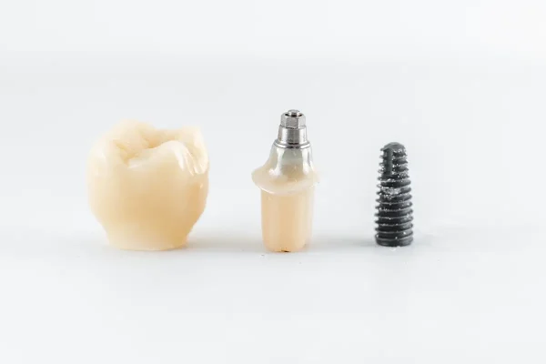 dental-implant-components dental-implant-components